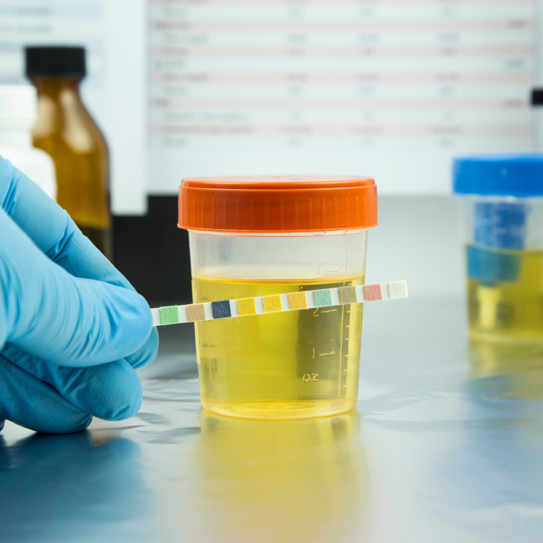 Drug and Alcohol Program for FRA Compliance